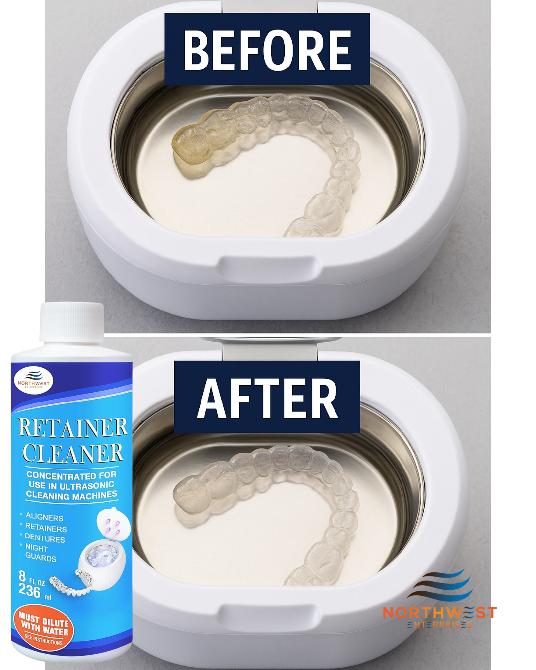 Crystal Clear Retainers Start Here – No More Funky Trays! – Northwest ...