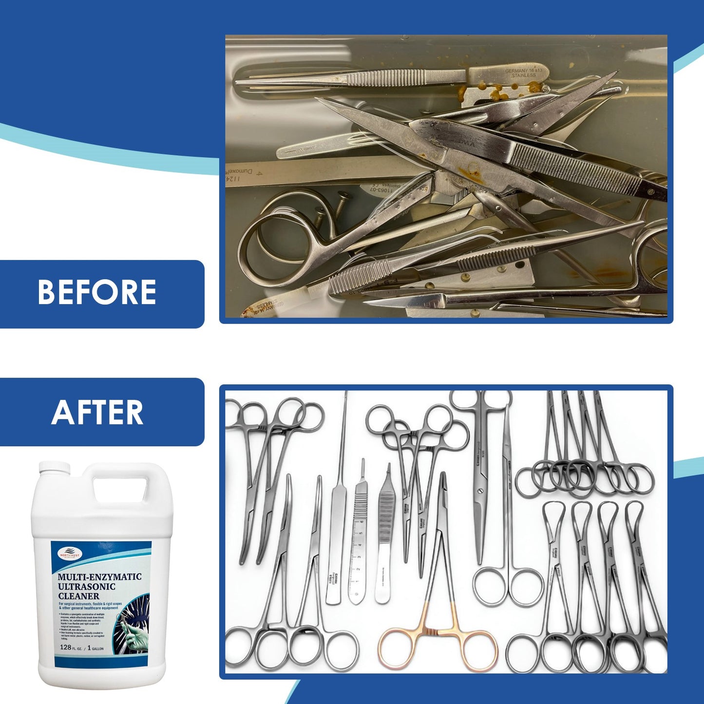 Multi-Enzymatic Ultrasonic Cleaner Solution for Professional Instrument and Equipment Reprocessing. Concentrated. One Gallon.